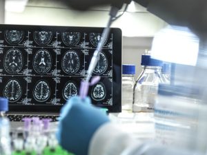 Novo tratamento pode controlar sintomas de Alzheimer, mostra estudo