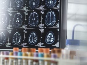 Copa do Brasil: veja classificados às quartas de final